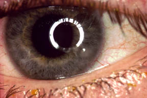 bild207