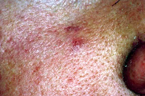 bild209