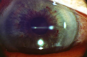 bild 232