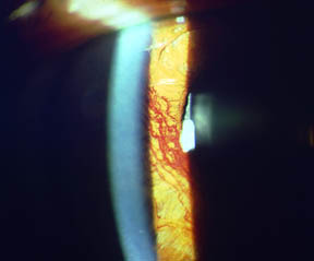 bild 2.46